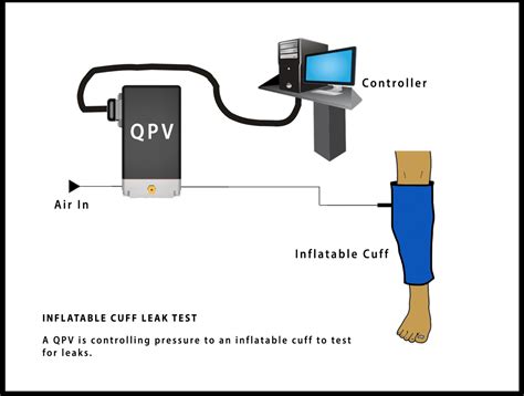 cuff leak test|Cuff